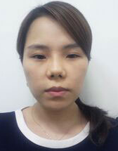 女神整形外科——做完眼睛鼻子真的变身女神_韩国女神整形外科整形案例