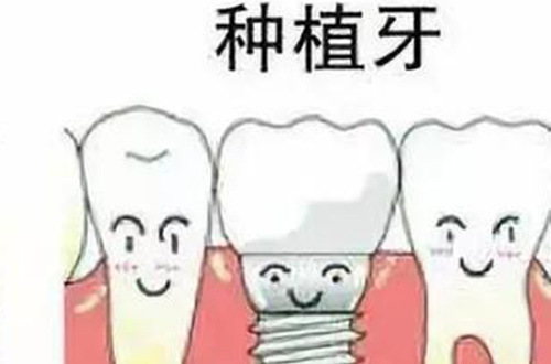 牙齿示例图