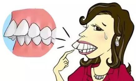 牙齿矫正对脸型有影响吗