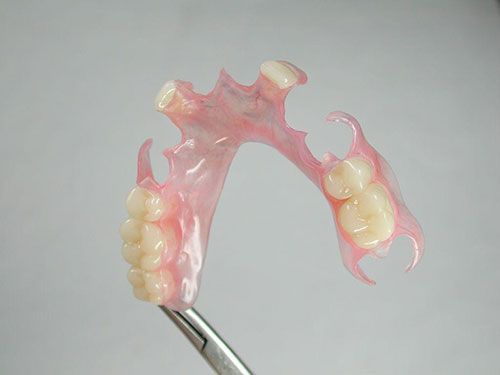 一颗牙活动义齿图片图片