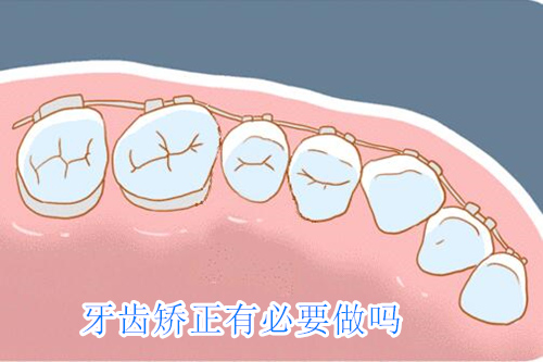 牙齿矫正有必要做吗？