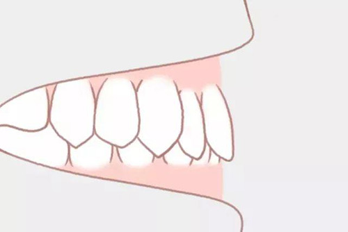 牙齿上下排的正确位置图片