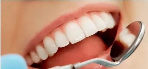 牙齿矫正之前需要洗牙