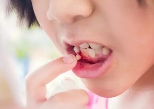 儿童牙外伤的处理方法是什么