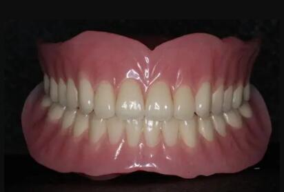 BPS吸附性义齿改善