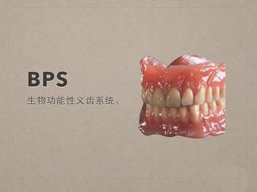 吸附性义齿BPS生物功能性义齿系统