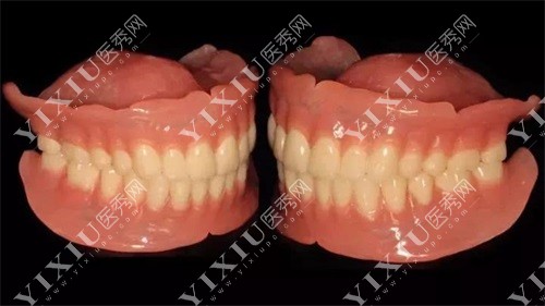 BPS吸附性义齿模型