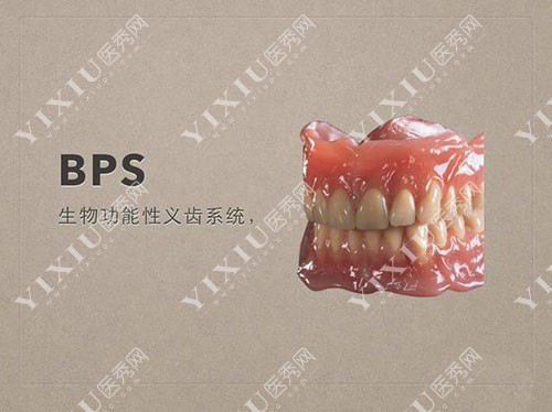 BPS吸附性义齿