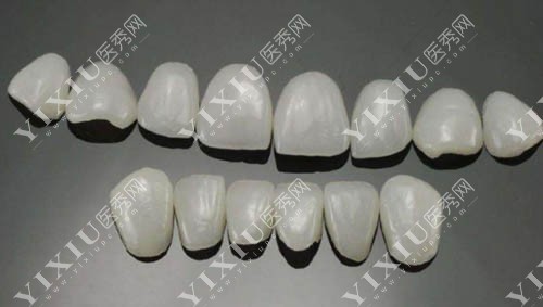 广州柏德口腔牙齿贴面材料展示