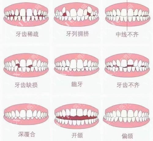 广州曙光口腔牙齿矫正问题改善汇总