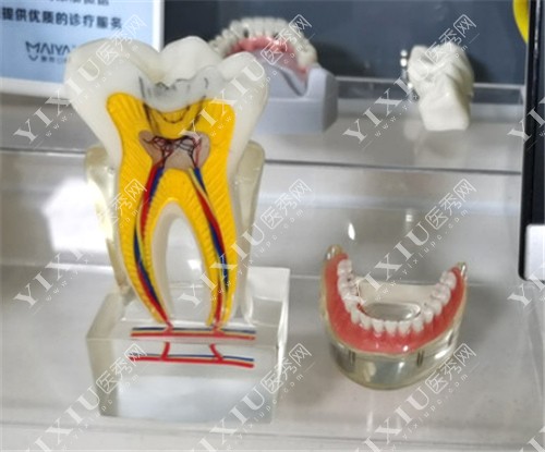 牙齿模型展示图