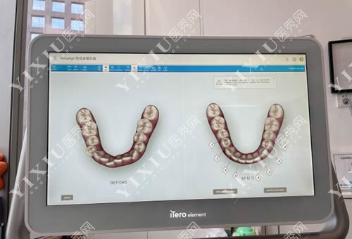 广州马泷齿科牙齿治疗方案设计