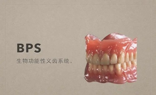 bps吸附性义齿是什么材料?与普通活动义齿区别不光是价格