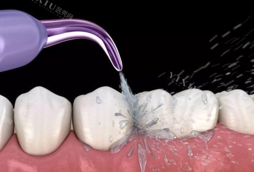 西安中诺口腔医院收费明细出炉！韩国进口种植牙2800元起／颗！(图5)