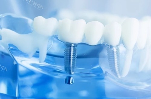 呼和浩特德盟口腔好吗？文内更新机构多项内部资料！(图6)