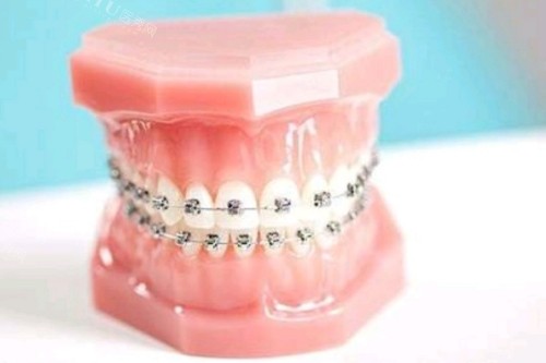 无锡新吴区整牙好的医院名单揭晓！5家技术在线的齿科推荐！(图2)