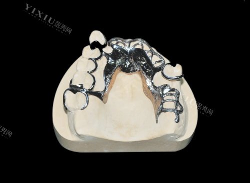 纯钛假牙托对人体有害吗？详细分析纯钛假牙的优点缺点！(图3)