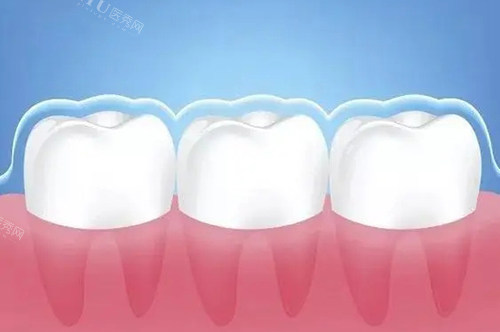 上海青苗口腔门诊部：专注儿童齿科项目，关爱孩子笑容(图3)