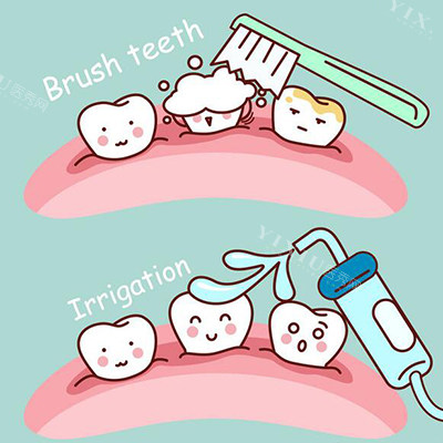 牙齿洁牙改善图展示