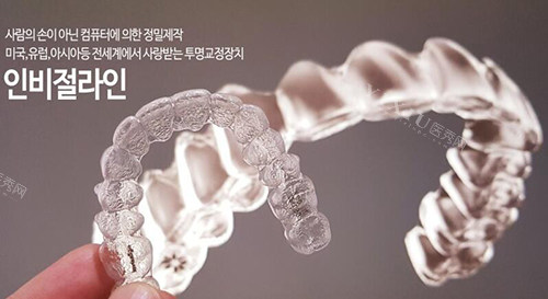 细品！我做隐适美正畸全过程经历揭秘！(图4)