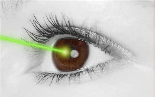 激光改善眼部手术图