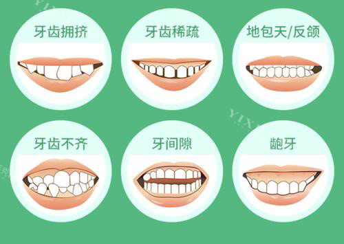 牙齿畸形各种程度示意图