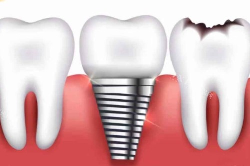 扬州贝舒特口腔怎么样？机构内部资料解答大家的疑问(图4)