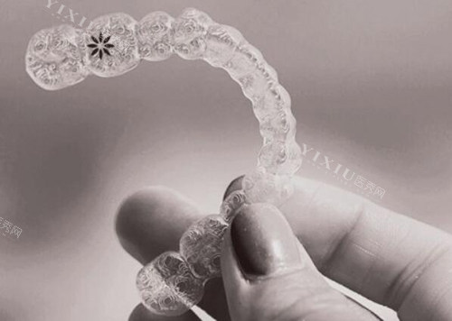 细品！我做隐适美正畸全过程经历揭秘！(图5)