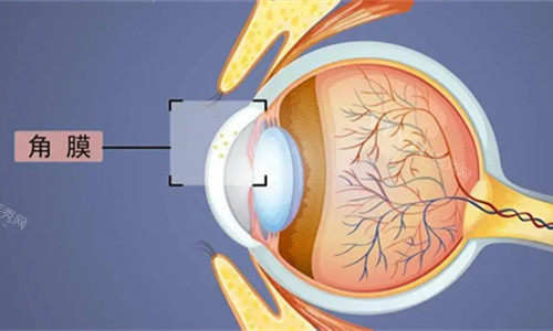 眼球角膜卡通展示图