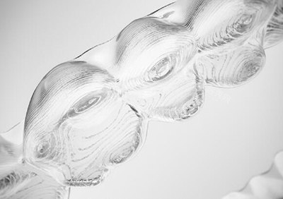 细品！我做隐适美正畸全过程经历揭秘！(图3)