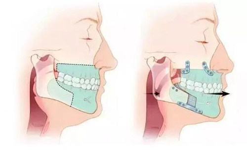 酒泉口腔医院看牙怎么样？就整牙项目优势为大家分享其特色(图4)