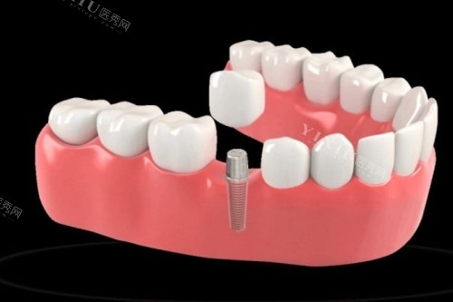 “大连美尔口腔”优势公开！老牌连锁机构技术／服务都在线(图4)