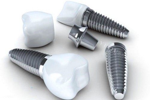 我在大同博诚全口种植经历分享：恢复自信微笑和健康口腔(图6)