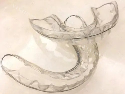 推荐吉林市正畸较好的医院，矫正牙齿这几家技术好网友评价高(图3)