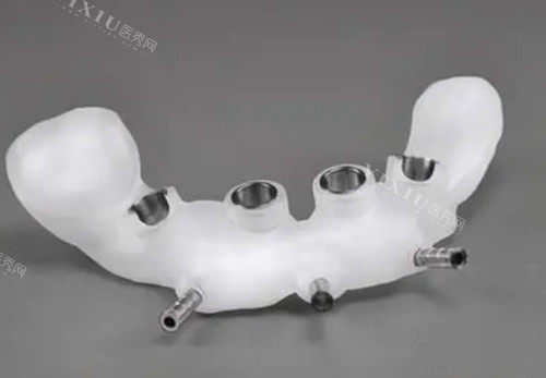 中老年人做全口种牙都要穿颧穿翼？骨量不足的种牙方案推荐(图1)