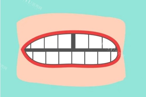 大门牙歪了一颗怎么矫正？除整牙外还有这些方法！