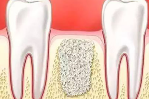 宜宾长宁县牙科收费大概什么水平？盘点常见牙科项目费用(图2)