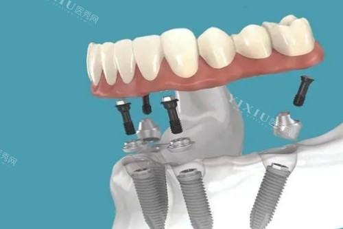 连云港成宏口腔怎么样？大型连锁品牌实力值得信赖！(图3)