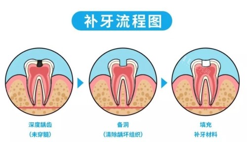 宝鸡补牙好的医院有哪些？技术好价格公道的机构送上！(图4)