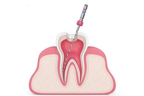 还再问苏州美奥口腔收费高吗？您想了解的牙科项目价格都在这！(图3)