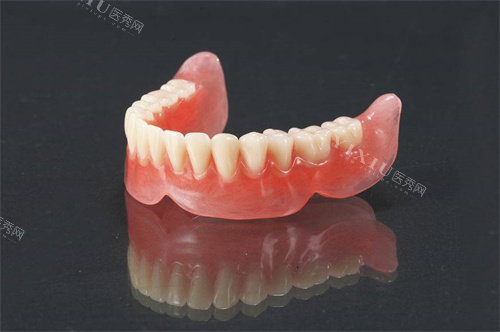 吸附假牙价格贵不贵？动辄上万元的产品优点是什么？(图2)