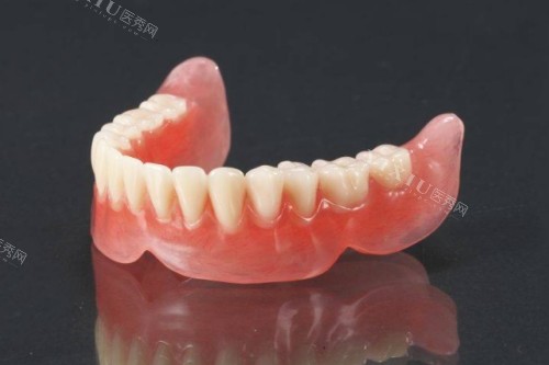 下半口牙缺失用什么办法好？种植or假牙如何选？(图2)