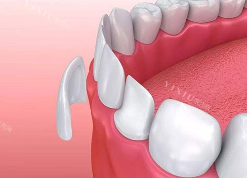 楚雄市牙科价目表，看牙不花冤枉钱，先看价格指南！(图1)