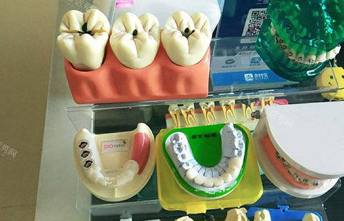 武汉华美口腔科看牙真划算，韩国奥齿泰植体3980真心不贵！(图5)