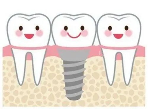 毕节牙科医院价格一览表：种植牙3500元起、牙齿矫正7798元起(图1)