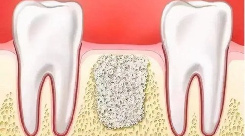 济南平阴种植牙医院排名及价格都有，多少钱一颗哪家便宜来这看(图2)
