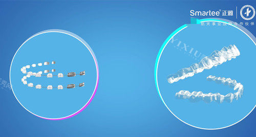 戴了隐形牙套不能不知道的几件事：不咬胶的危害首当其冲(图1)