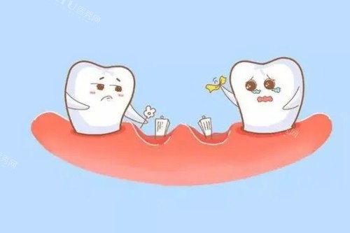 牙体缺失怎么办