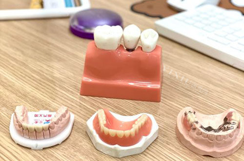 武汉固康口腔真不错，种植牙1880元起技术靠谱收费也划算！(图4)