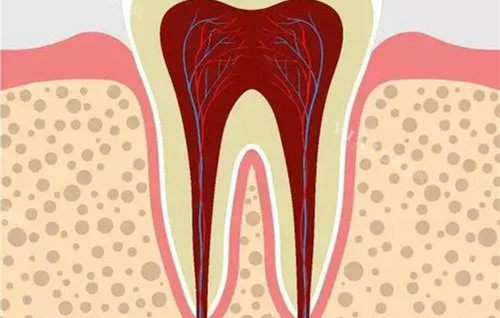牙髓内部展示图